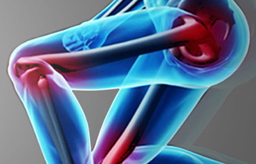 Total Hip Replacement