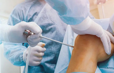 Knee Arthroscopy (Meniscus, ACL, PCL)