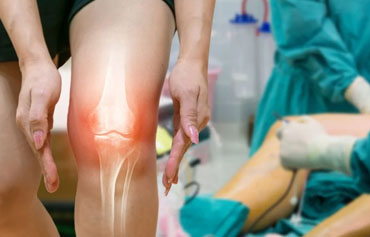 Ligament Reconstruction (ACL, PCL, MCL)