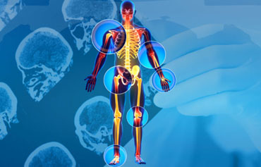 Degenerative Spine Conditions