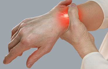 Carpal Tunnel Release